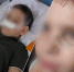 «Бросила в него бутылку»: в новосибирской школе девочка сломала нос однокласснику - Precedent.TV